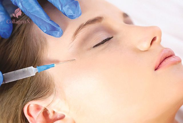 Tiêm Botox Xóa Nhăn